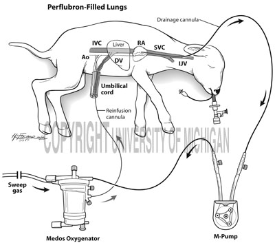 Schematic of artificial placenta using sheep model